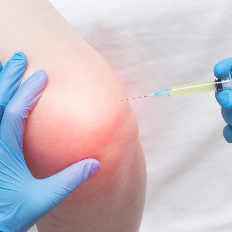 The,Doctor,Injects,Plasma,Into,A,Sore,,Inflamed,Female,Knee